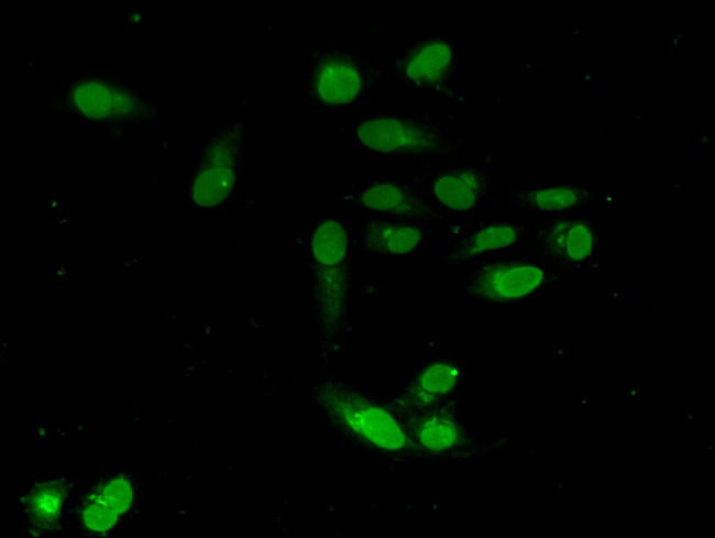 Emerin Antibody in Immunocytochemistry (ICC/IF)