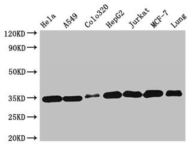 Emerin Antibody in Western Blot (WB)