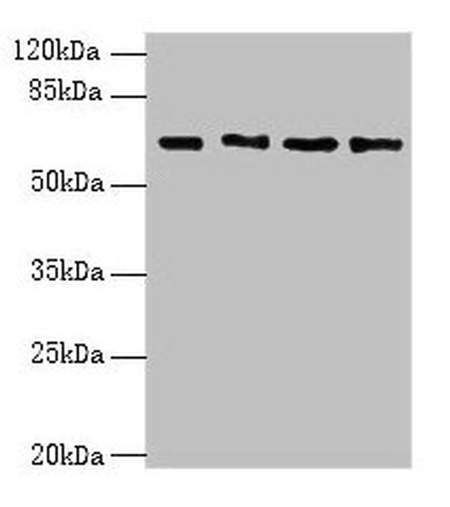 ENC1 Antibody in Western Blot (WB)