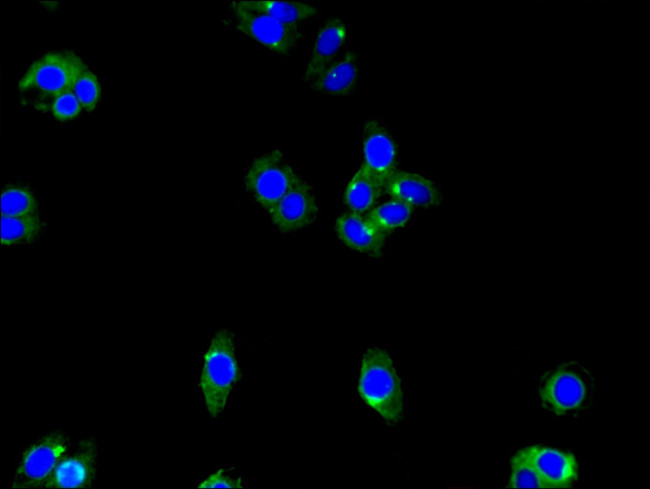 ENTPD8 Antibody in Immunocytochemistry (ICC/IF)