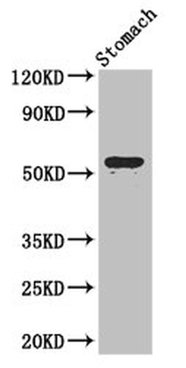 ENTPD8 Antibody in Western Blot (WB)