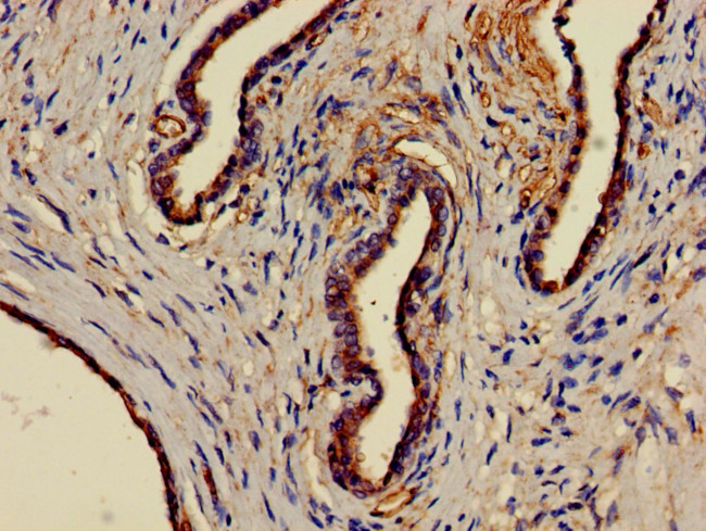 EPHX1 Antibody in Immunohistochemistry (Paraffin) (IHC (P))