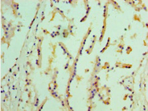 EPHX1 Antibody in Immunohistochemistry (Paraffin) (IHC (P))