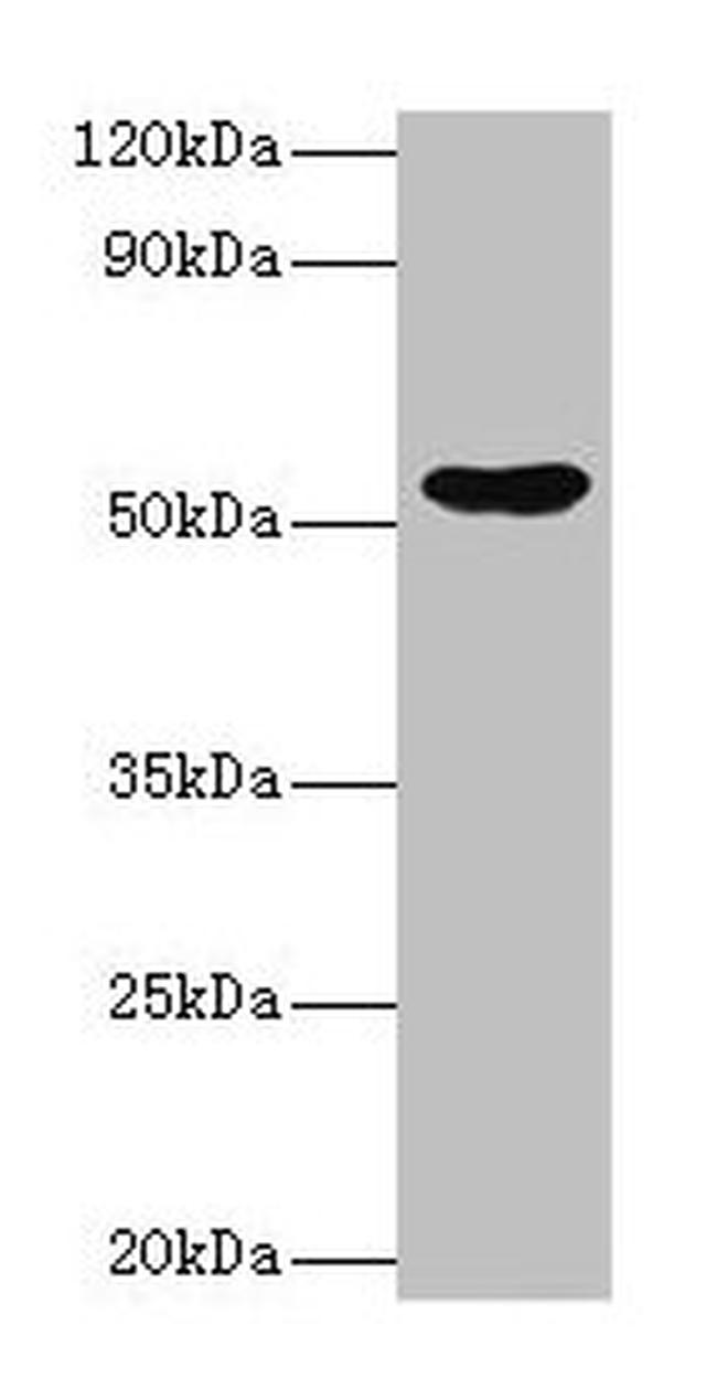 EPHX1 Antibody in Western Blot (WB)