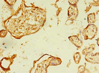 ERLIN1 Antibody in Immunohistochemistry (Paraffin) (IHC (P))