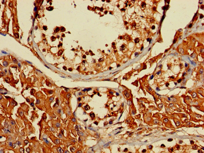 ERLIN1 Antibody in Immunohistochemistry (Paraffin) (IHC (P))