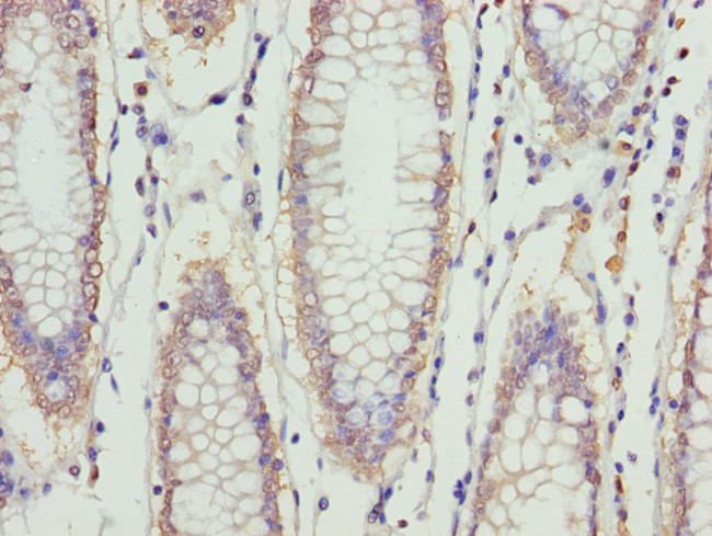 ERLIN2 Antibody in Immunohistochemistry (Paraffin) (IHC (P))