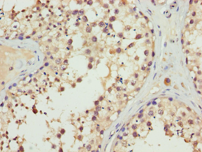 ERLIN2 Antibody in Immunohistochemistry (Paraffin) (IHC (P))