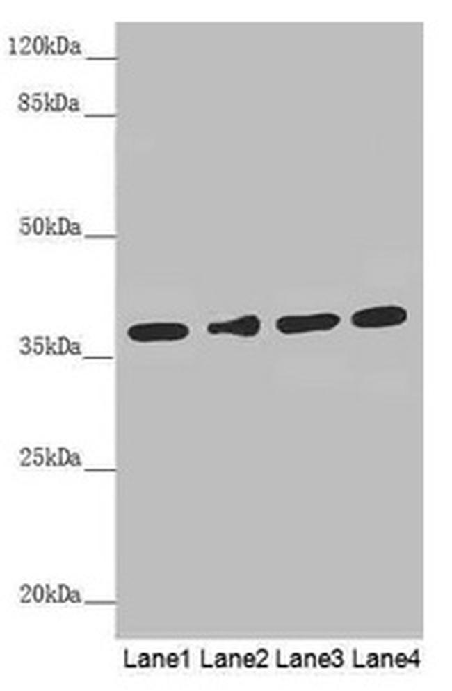 ERLIN2 Antibody in Western Blot (WB)