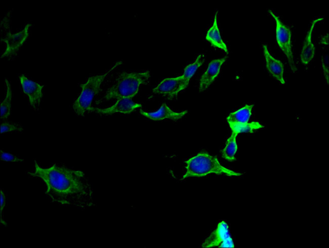 Prothrombin Antibody in Immunocytochemistry (ICC/IF)