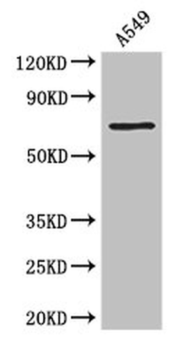 Prothrombin Antibody in Western Blot (WB)