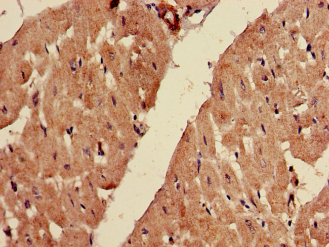 FADS1 Antibody in Immunohistochemistry (Paraffin) (IHC (P))