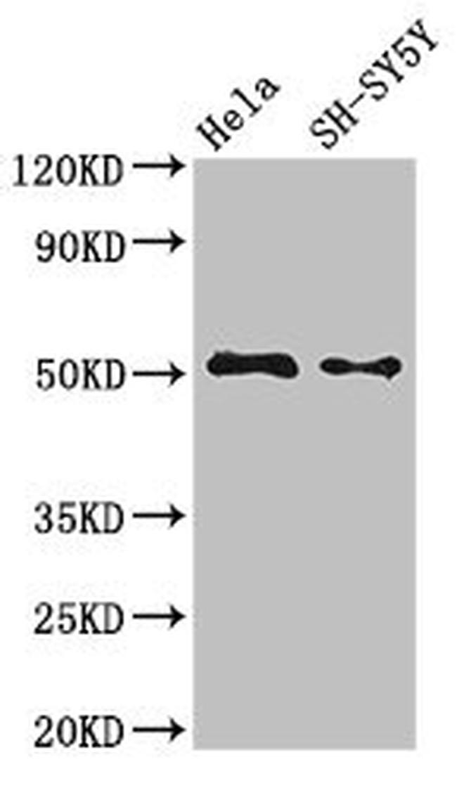 FADS1 Antibody in Western Blot (WB)