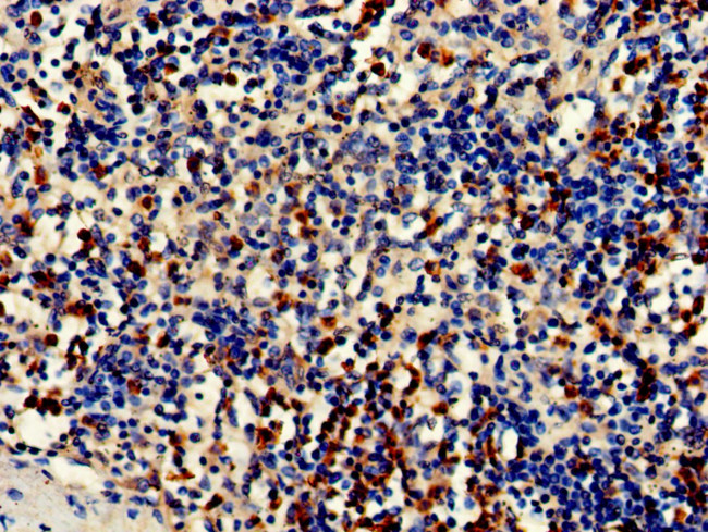 CDA Antibody in Immunohistochemistry (Paraffin) (IHC (P))