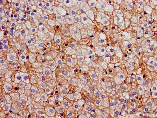 FDFT1 Antibody in Immunohistochemistry (Paraffin) (IHC (P))