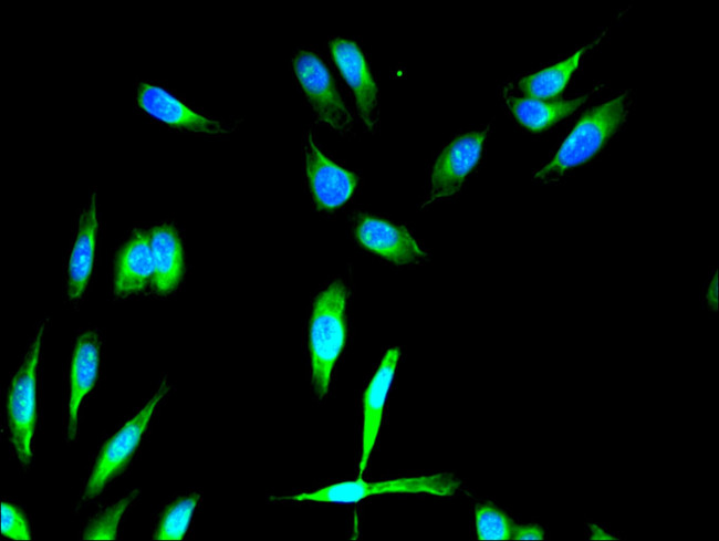 FGFR1 Antibody in Immunocytochemistry (ICC/IF)