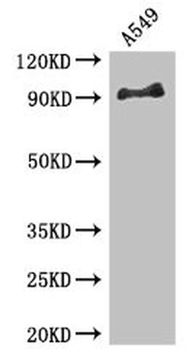 FGFR1 Antibody in Western Blot (WB)