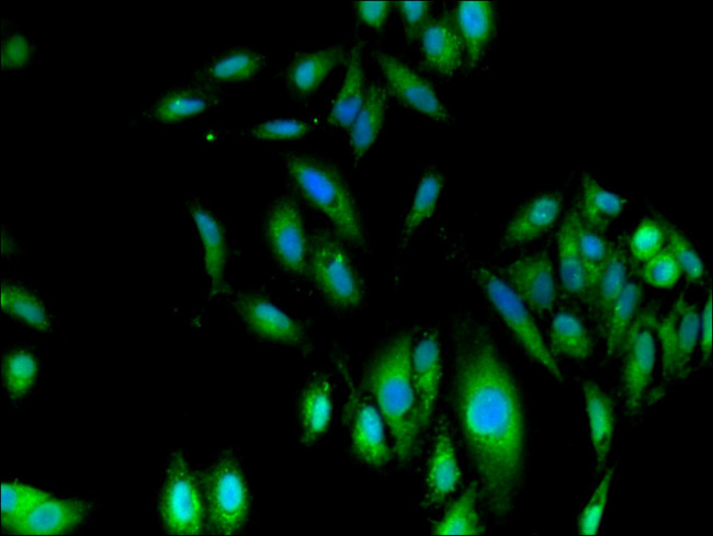 Fumarase Antibody in Immunocytochemistry (ICC/IF)