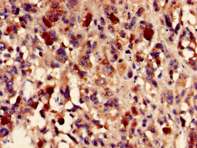 Fumarase Antibody in Immunohistochemistry (Paraffin) (IHC (P))