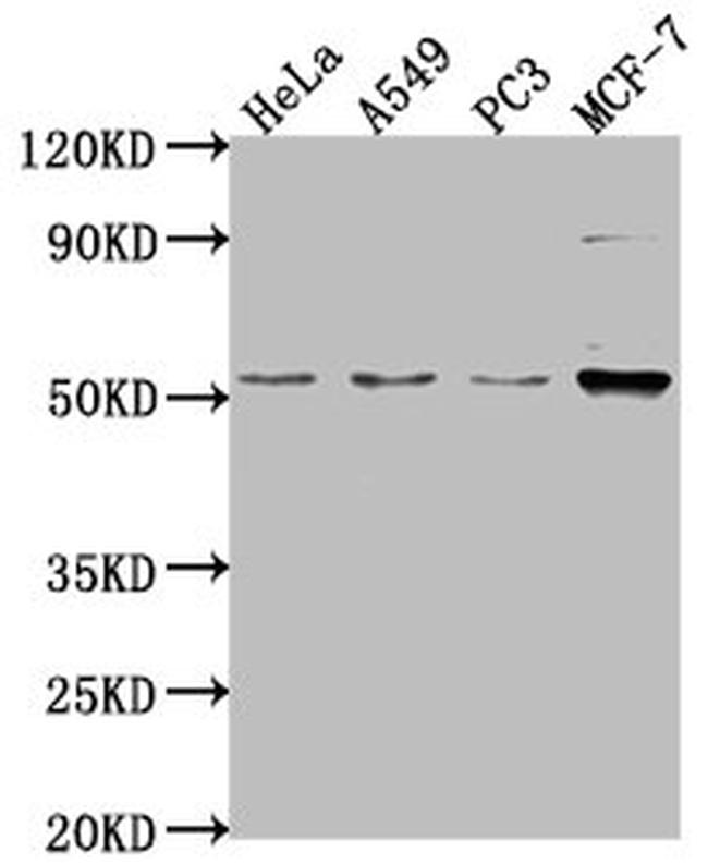 FKTN Antibody in Western Blot (WB)