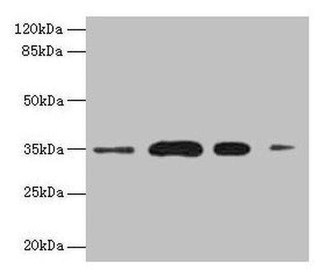 SULT1A3 Antibody in Western Blot (WB)