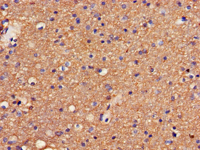 GABRA4 Antibody in Immunohistochemistry (Paraffin) (IHC (P))