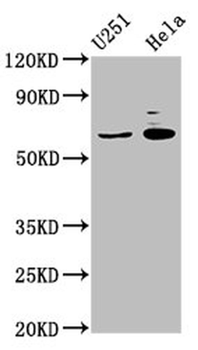 GABRA4 Antibody in Western Blot (WB)