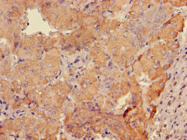 GABRB3 Antibody in Immunohistochemistry (Paraffin) (IHC (P))