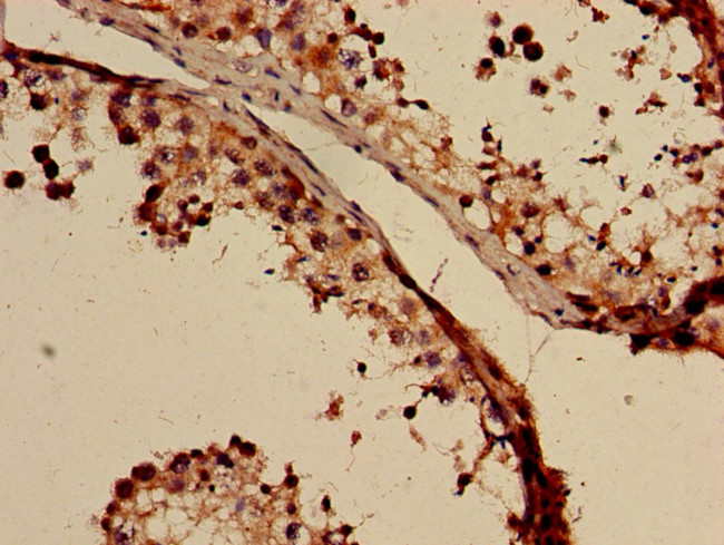 GABRB3 Antibody in Immunohistochemistry (Paraffin) (IHC (P))