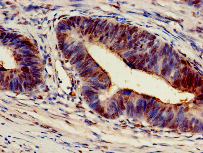 ARF4 Antibody in Immunohistochemistry (Paraffin) (IHC (P))