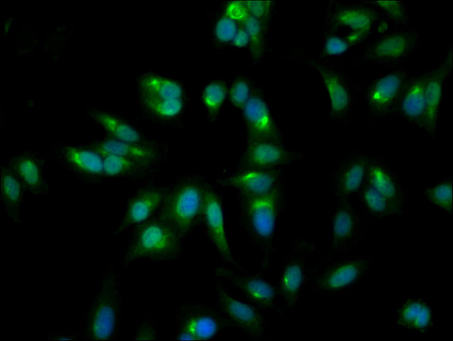 GALT Antibody in Immunocytochemistry (ICC/IF)