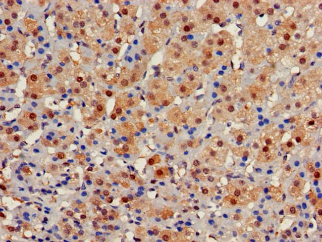 GALT Antibody in Immunohistochemistry (Paraffin) (IHC (P))