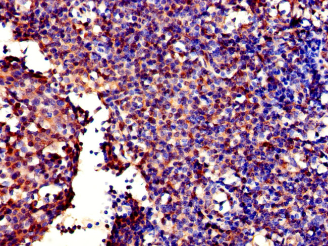 GALT Antibody in Immunohistochemistry (Paraffin) (IHC (P))