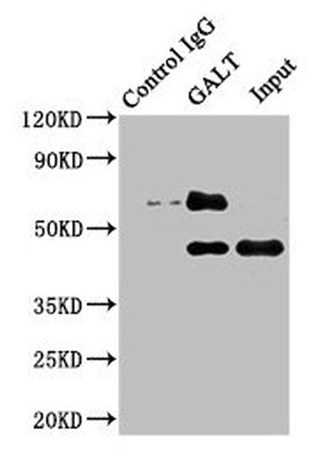 GALT Antibody in Western Blot (WB)