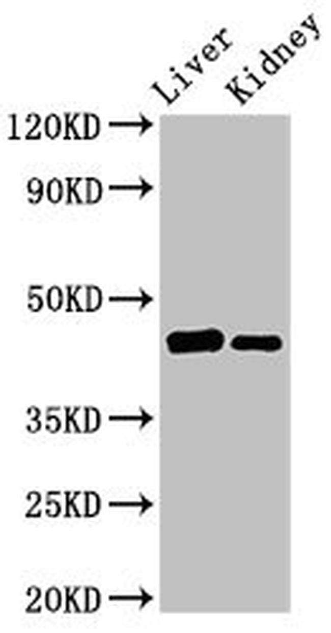 GALT Antibody in Western Blot (WB)