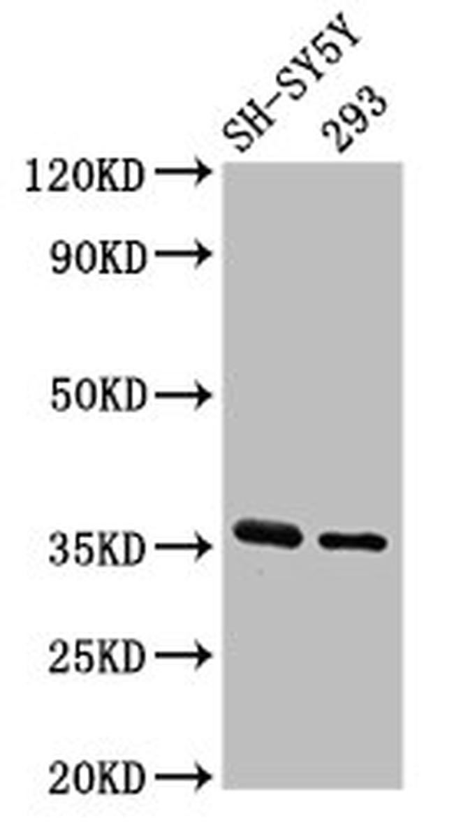 GAS1 Antibody in Western Blot (WB)