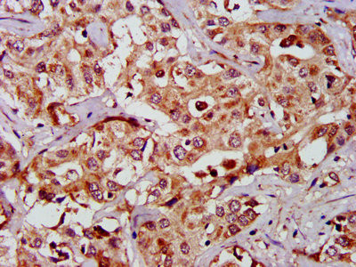 GAS2 Antibody in Immunohistochemistry (Paraffin) (IHC (P))