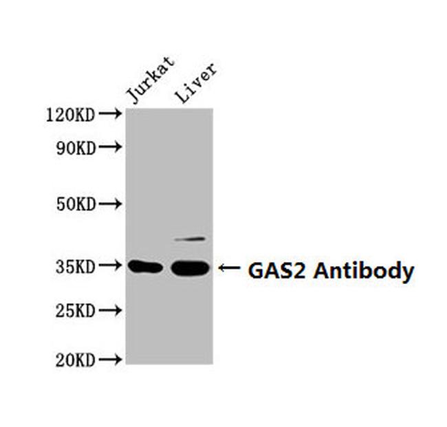 GAS2 Antibody in Western Blot (WB)