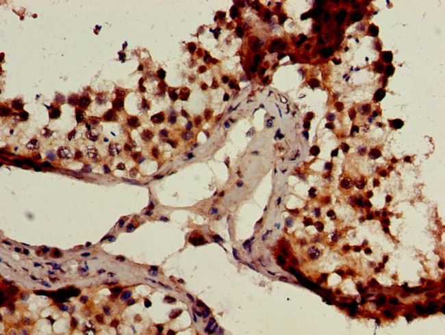 GCM2 Antibody in Immunohistochemistry (Paraffin) (IHC (P))