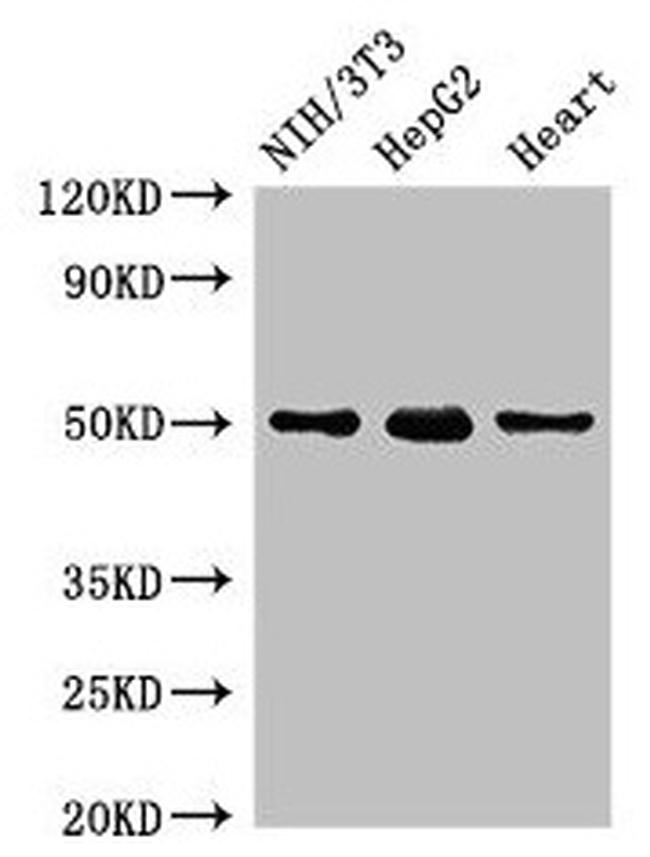 GCM2 Antibody in Western Blot (WB)