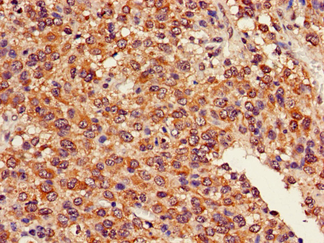 GDAP1L1 Antibody in Immunohistochemistry (Paraffin) (IHC (P))