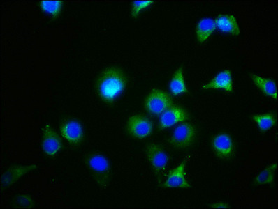 GDF5 Antibody in Immunocytochemistry (ICC/IF)
