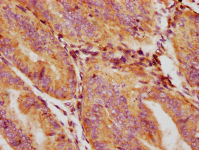 GDF5 Antibody in Immunohistochemistry (Paraffin) (IHC (P))