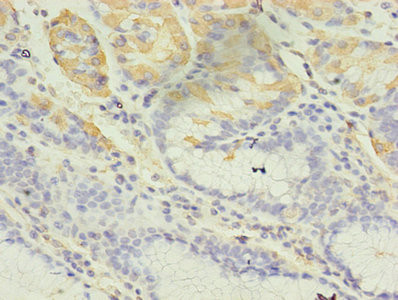 GIF Antibody in Immunohistochemistry (Paraffin) (IHC (P))