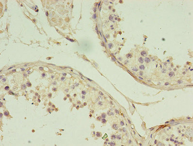 GIF Antibody in Immunohistochemistry (Paraffin) (IHC (P))