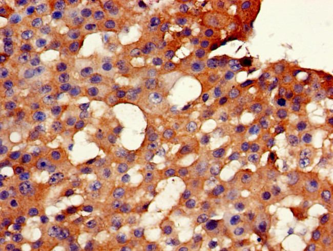 GK2 Antibody in Immunohistochemistry (Paraffin) (IHC (P))