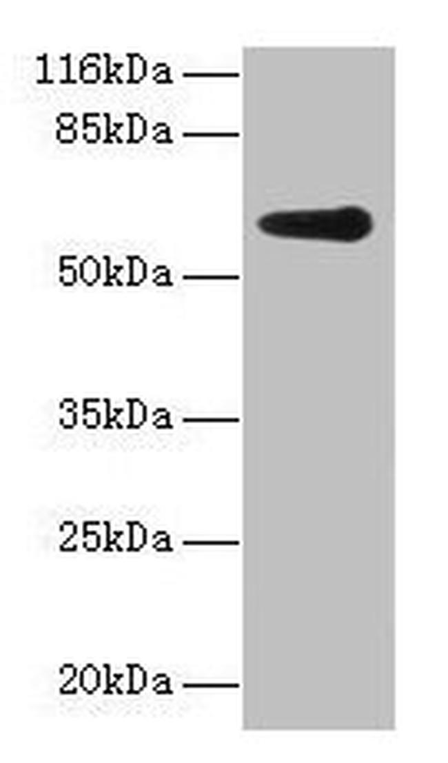 GK2 Antibody in Western Blot (WB)