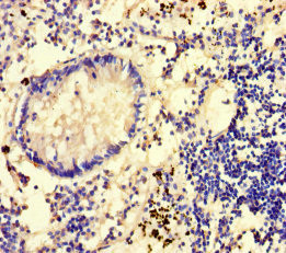 GLCE Antibody in Immunohistochemistry (Paraffin) (IHC (P))