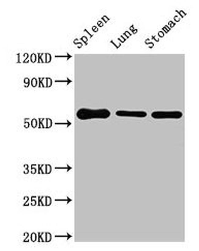 GLP1R Antibody in Western Blot (WB)