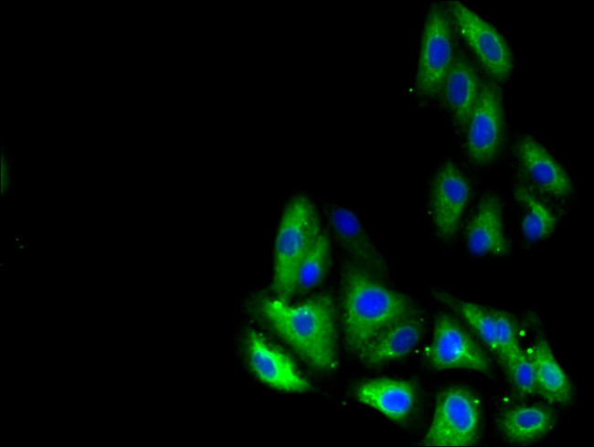 GLP1R Antibody in Immunocytochemistry (ICC/IF)